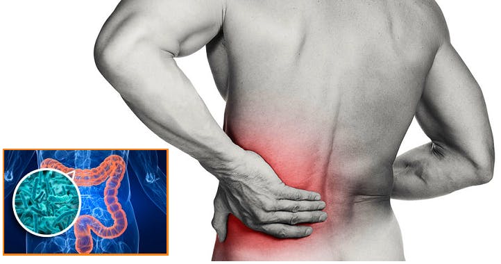 Colon Irritabile E Mal Di Schiena Bodybuilding Natural Com